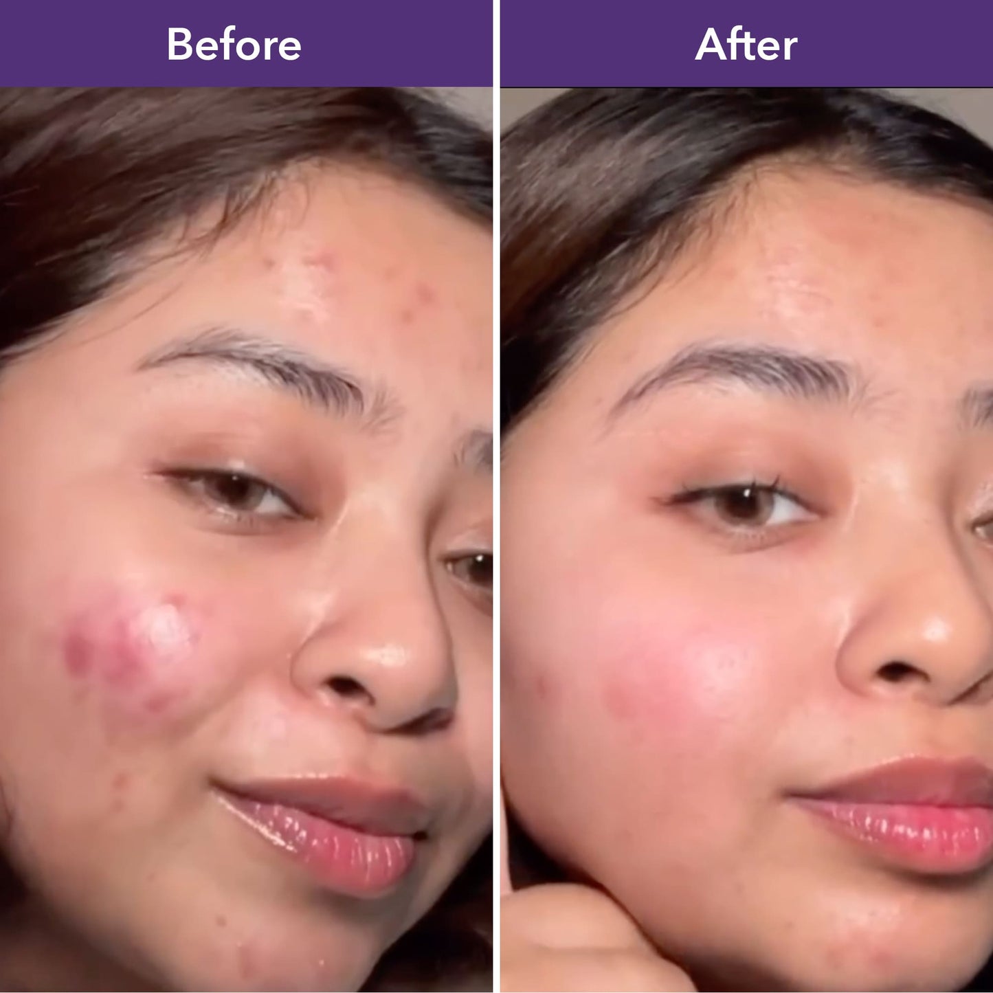 Luminize (Skin Glow)