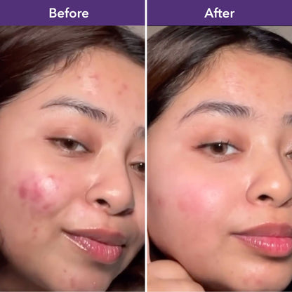 Luminize (Skin Glow)