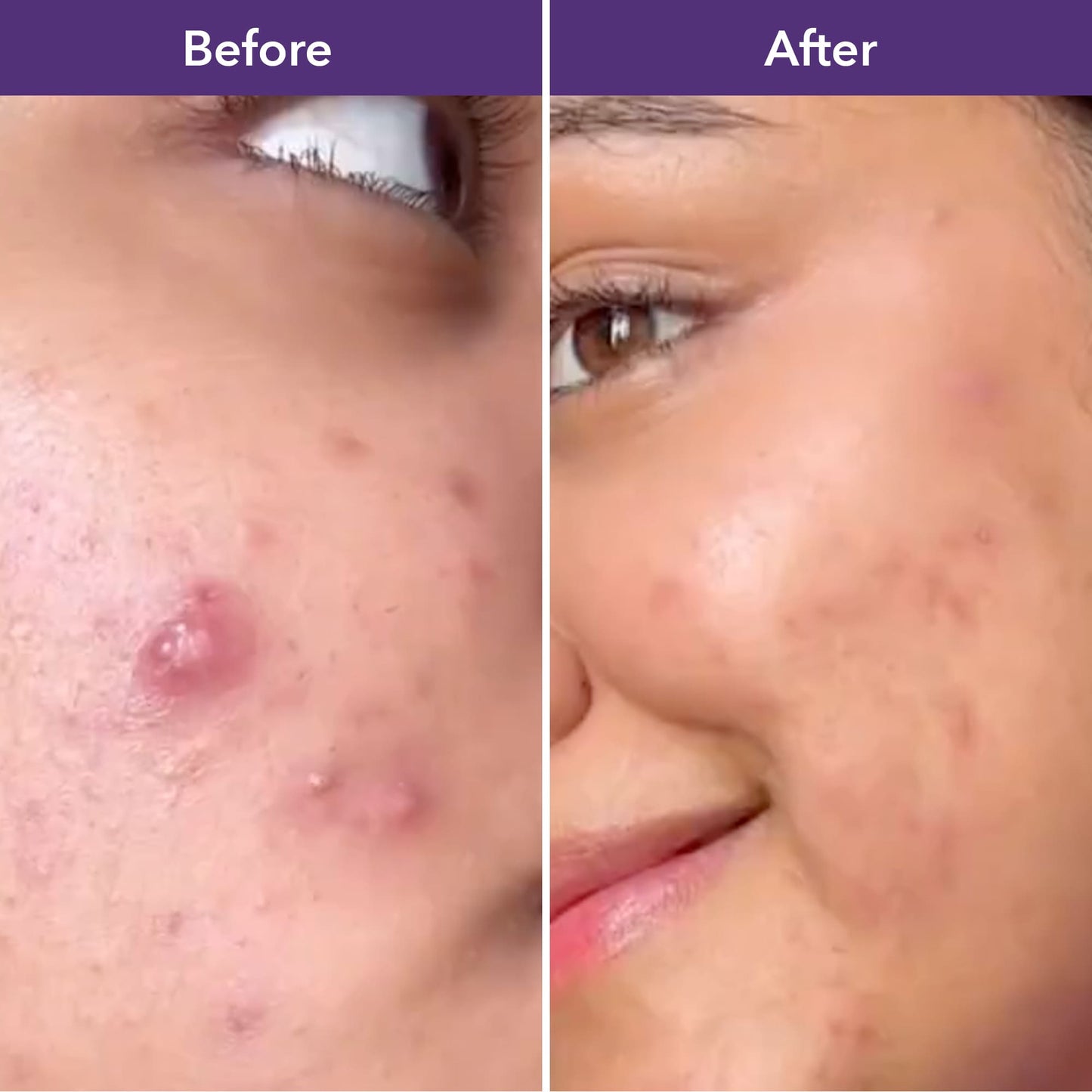 Luminize (Skin Glow)