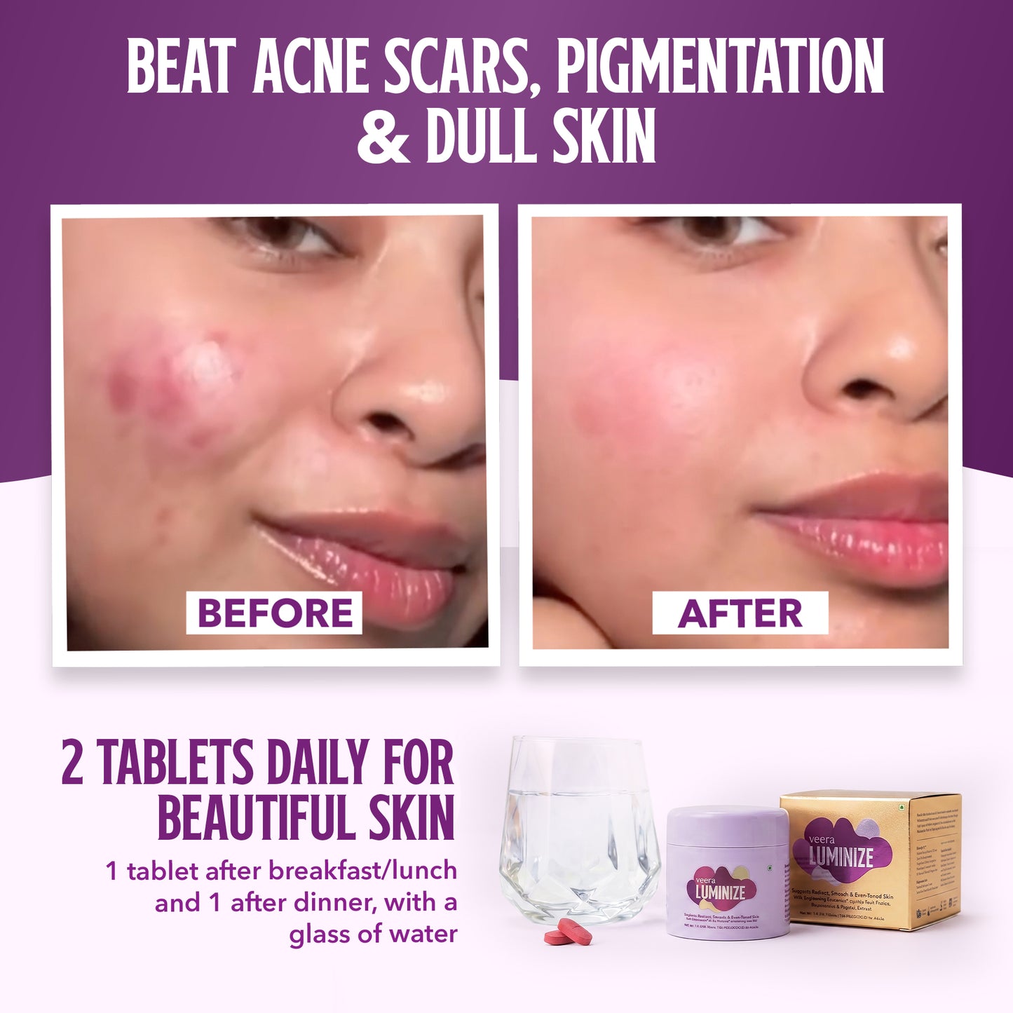 PCOS Skin Glow Duo