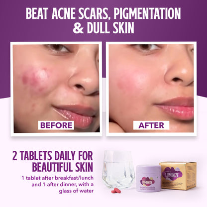 PCOS Skin Glow Duo